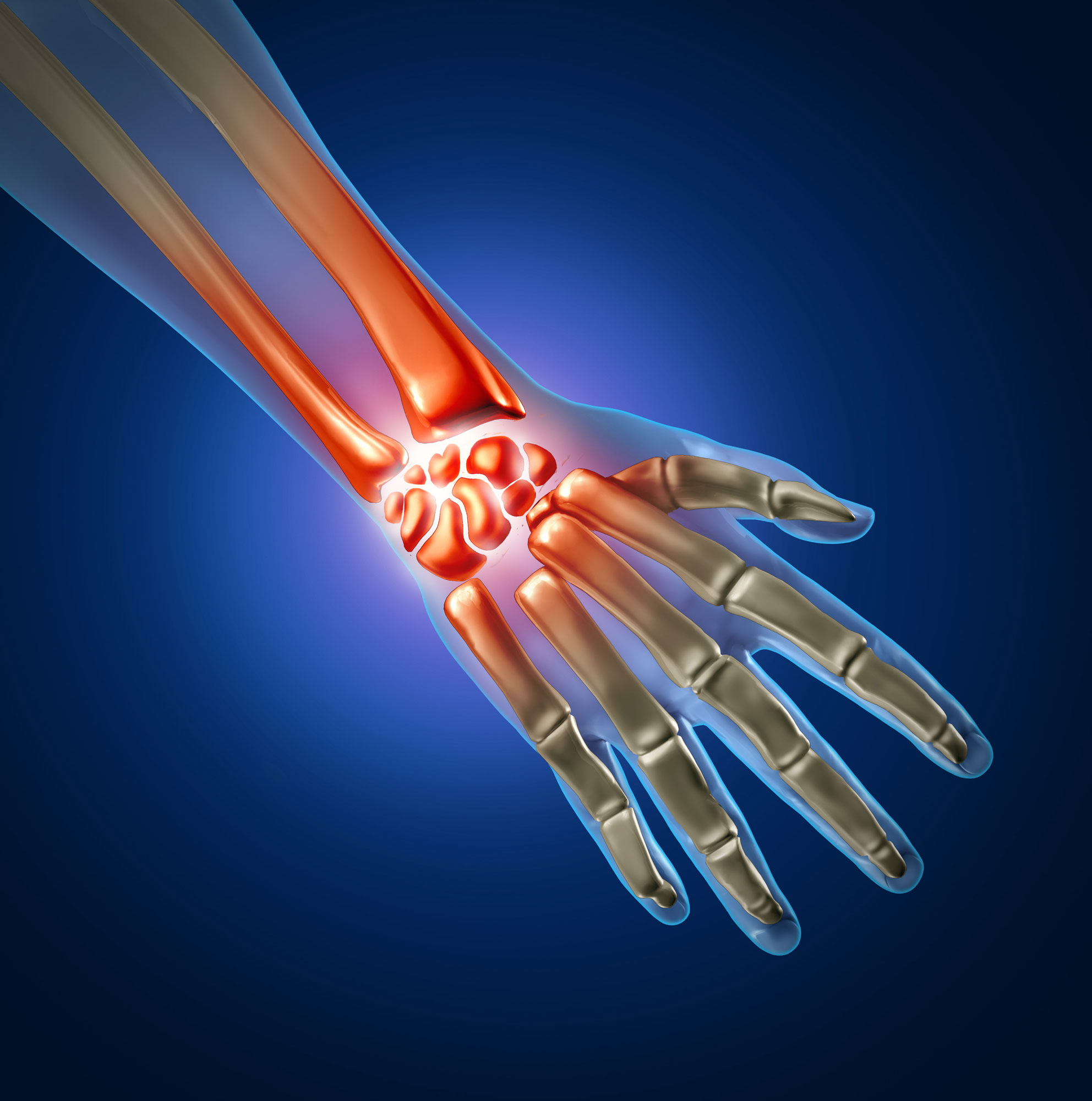 Gaming Injuries Breckland Osteopaths