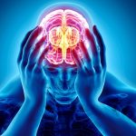 Frontal migraine